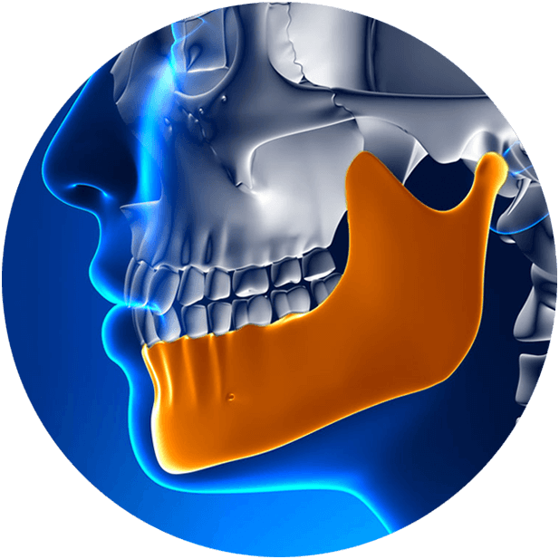 bone health implants sadiq