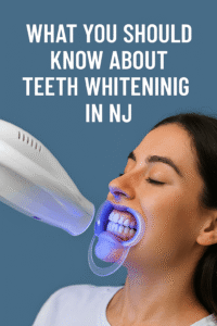 what-you-should-know-about-teeth-whitening-in-nj